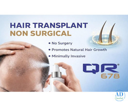 Hair Transplant Non Surgical for Natural Hair Growth