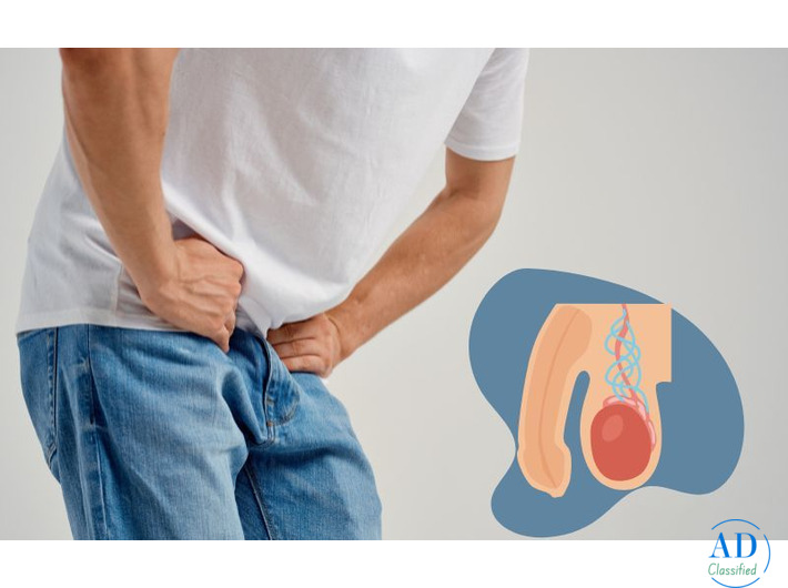 Effective Varicocele Treatment for Pain Relief and Improved Fertility