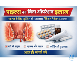 पाइल्स का बिना ऑपरेशन इलाज