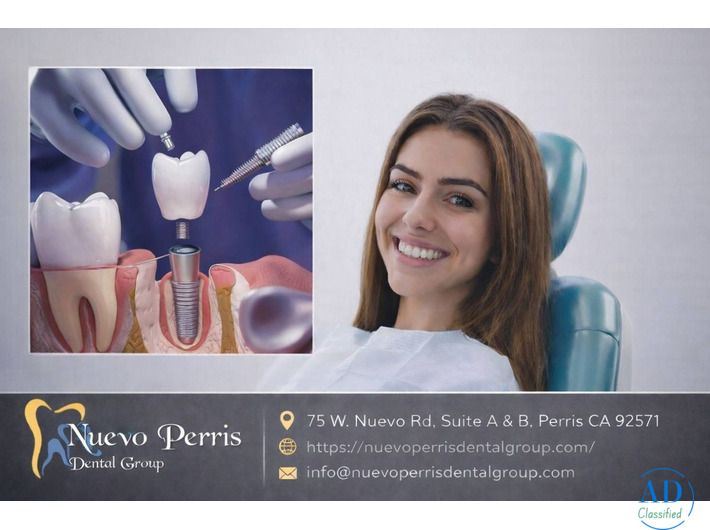 Dental Implants Treatment in Moreno Valley - Dr. Tejas Modi