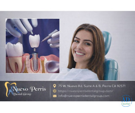 Dental Implants Treatment in Moreno Valley - Dr. Tejas Modi