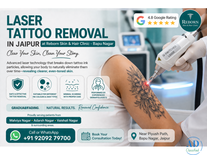 Get Tattoo Removal in Jaipur at Reborn Skin & Hair Clinic, Bapu Nagar