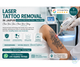 Get Tattoo Removal in Jaipur at Reborn Skin &amp; Hair Clinic, Bapu Nagar