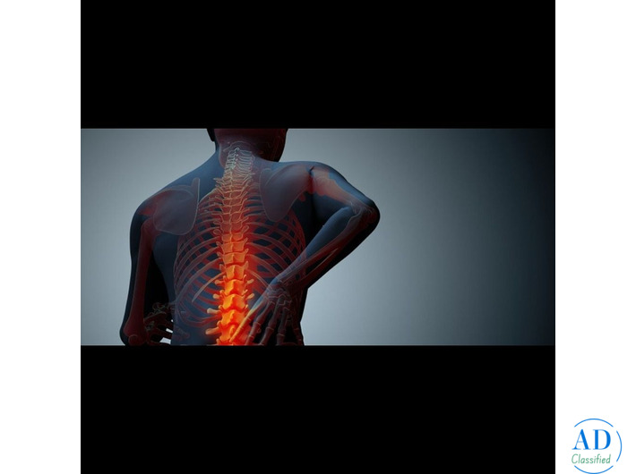 How to Choose the Best Spine Doctor for Effective Back Pain Treatment