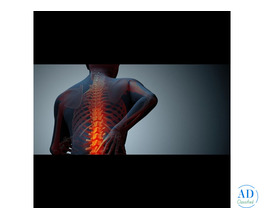 How to Choose the Best Spine Doctor for Effective Back Pain Treatment