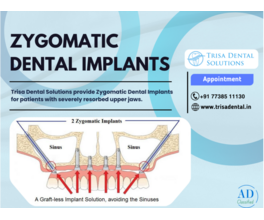 Zygomatic Dental Implants in Mumbai – No Bone Grafting Required