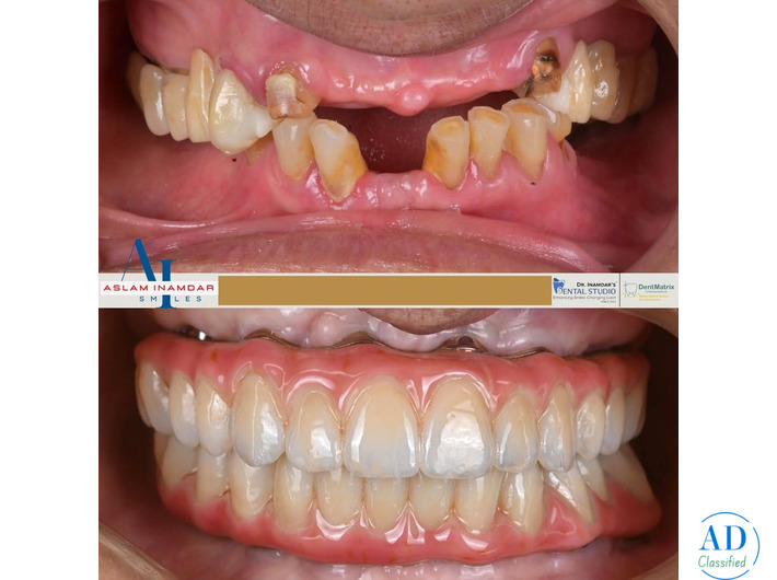 A Total Smile Transformation in Mumbai