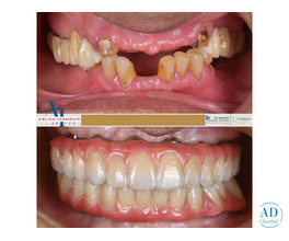 A Total Smile Transformation in Mumbai