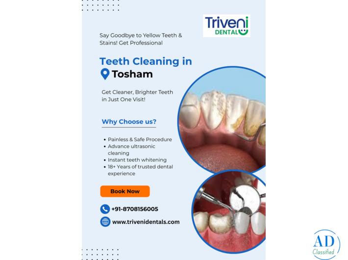Teeth Cleaning in Tosham | Triveni Dental
