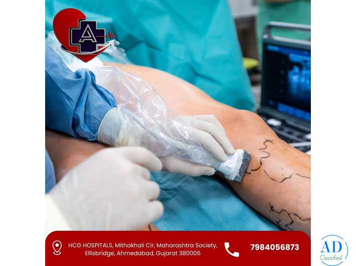 Smart treatment approach for Vascular Surgery in Ahmedabad Dr Abhishek Parmar
