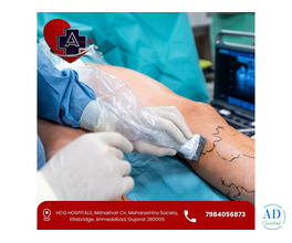 Smart treatment approach for Vascular Surgery in Ahmedabad Dr Abhishek Parmar