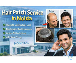 Apolo Hair Studio: Top Hair Patch Service in Noida for Hair Loss