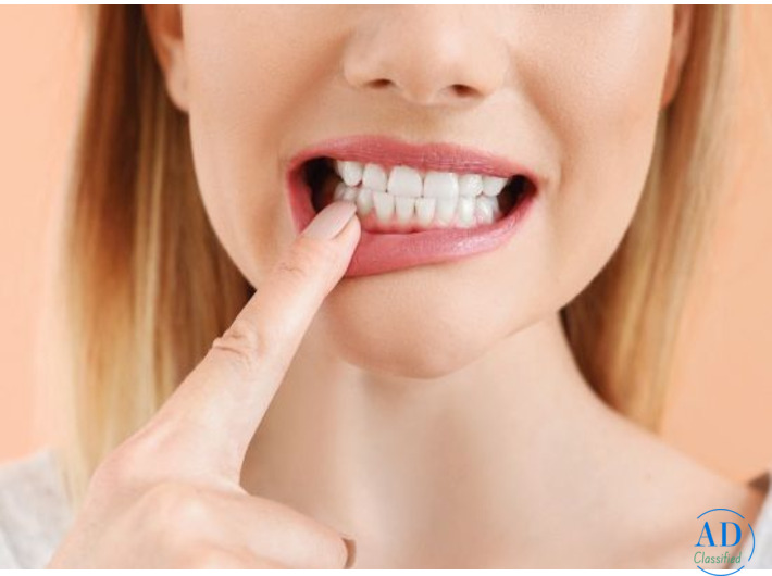 Non-Surgical Gum Treatment in Moreno Valley - Dr. Tejas Modi