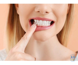 Non-Surgical Gum Treatment in Moreno Valley - Dr. Tejas Modi