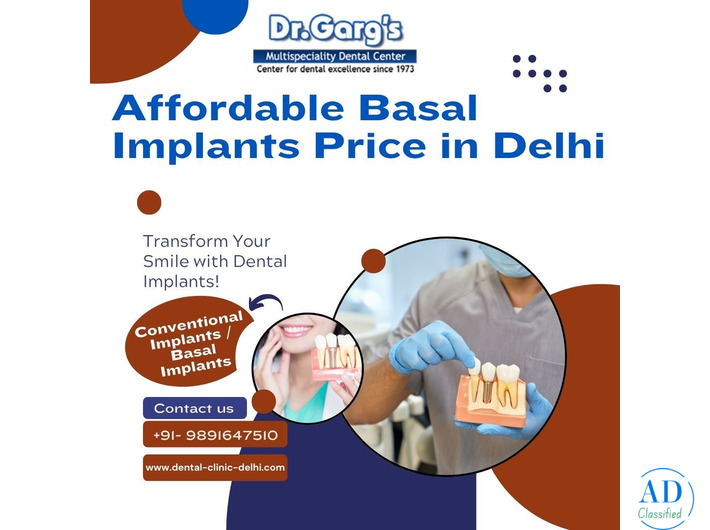 Affordable Basal Implants Price in Delhi at Dr. Garg’s Multispeciality Dental Center