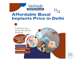 Affordable Basal Implants Price in Delhi at Dr. Garg’s Multispeciality Dental Center