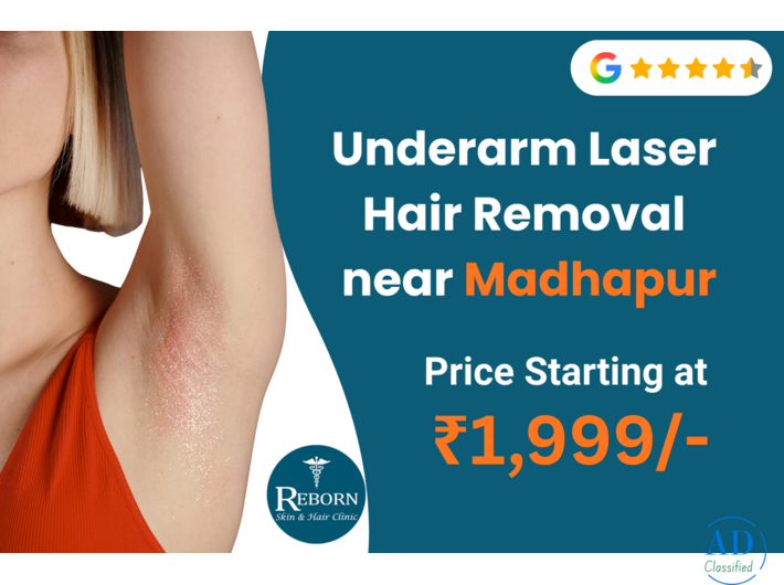 Underarm Laser Hair Removal Near Madhapur | Effortless Smoothness with Advanced Laser Care