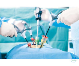 Best Hospital for Laser Surgery in Indirapuram India