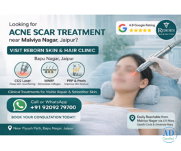 Get Acne Scar Treatment in Jaipur Near Malviya Nagar