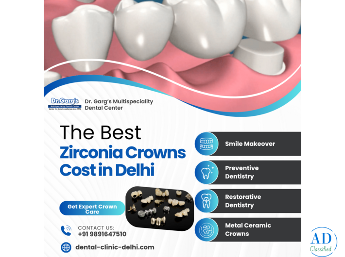 Best Zirconia Crowns Cost in Delhi at Dr. Garg’s Multispeciality Dental Center