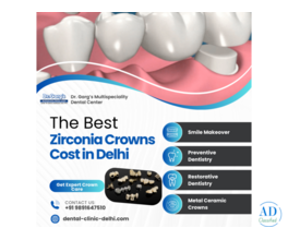 Best Zirconia Crowns Cost in Delhi at Dr. Garg’s Multispeciality Dental Center
