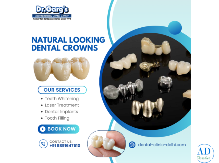 Natural Looking Dental Crowns at Dr. Garg’s Multispeciality Dental Center