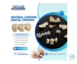 Natural Looking Dental Crowns at Dr. Garg’s Multispeciality Dental Center