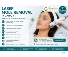 Clear Your Skin with Advanced Laser Mole Removal in Jaipur