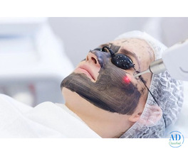 Carbon Laser Peel Facial Near Me in Pune | Arnica Clinic Experts