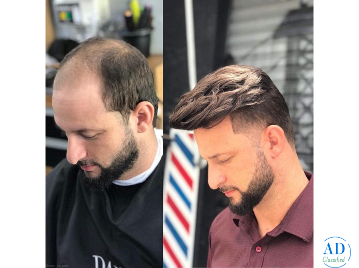 Buy Toupee for Men Online with Easy Fit and Natural Appearance