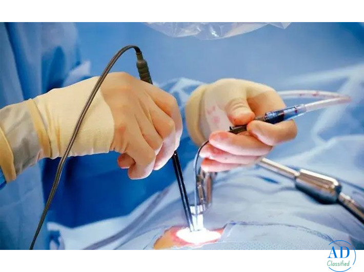 Top Best Hernia Surgeons in Indirapuram