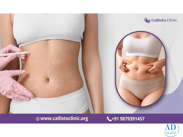 Liposuction Services by Dr. Rushin Thakor - Callisto Clinic
