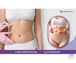 Liposuction Services by Dr. Rushin Thakor - Callisto Clinic