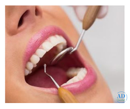 Root Canal Treatment in Silchar | Gentle, Advanced Care at Dento Derma