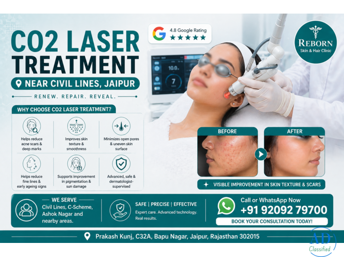CO2 Laser Treatment near Civil Lines, Jaipur - Get Flawless Skin