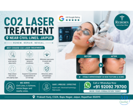 CO2 Laser Treatment near Civil Lines, Jaipur - Get Flawless Skin