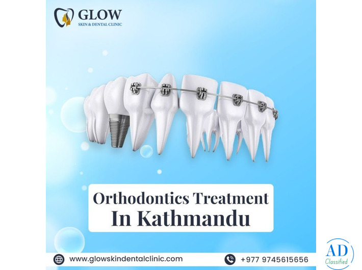 Best Orthodontics Treatment in Kathmandu