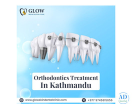 Best Orthodontics Treatment in Kathmandu