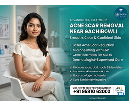 Acne Scar Removal near Gachinowli in Hyderabad | Clear Skin Solutions
