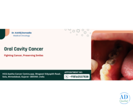 Oral Cavity Cancer Specialist Doctor in Ahmedabad - Advanced Treatment &amp; Care