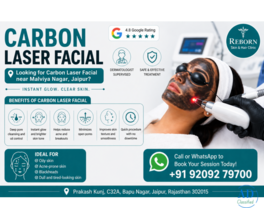 Get Carbon Laser Facial near Malviya Nagar, Jaipur for Acne