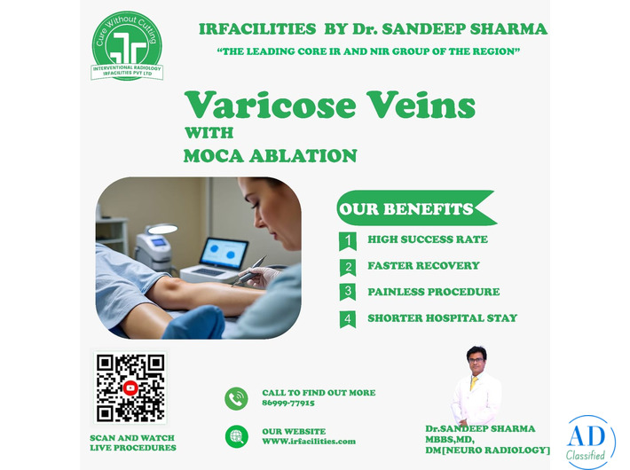 Choosing the Right Varicose Veins Specialist for Lasting Relief