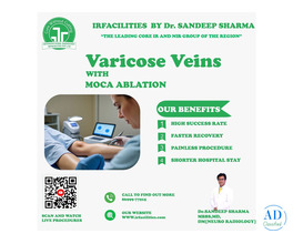Choosing the Right Varicose Veins Specialist for Lasting Relief