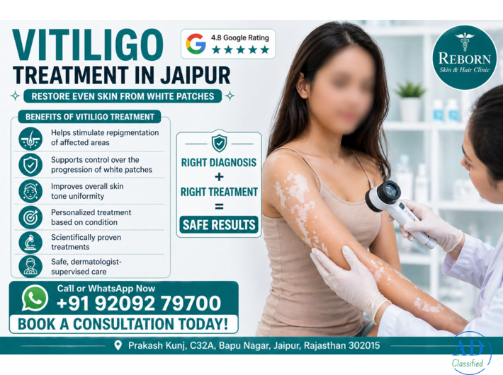Safe Vitiligo Treatment in Jaipur - Reduce White Patches Effectively