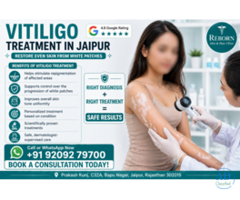 Safe Vitiligo Treatment in Jaipur - Reduce White Patches Effectively