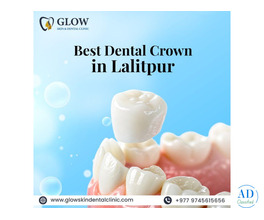 Best Dental Crown in Lalitpur