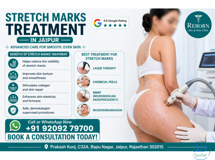 Stretch Marks Treatment in Jaipur - Visible Results by Experts