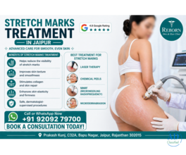 Stretch Marks Treatment in Jaipur - Visible Results by Experts