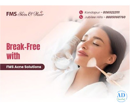Best Acne Treatment in Hyderabad – FMS Skin & Hair