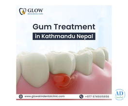 Best Gum treatment in Kathmandu Nepal